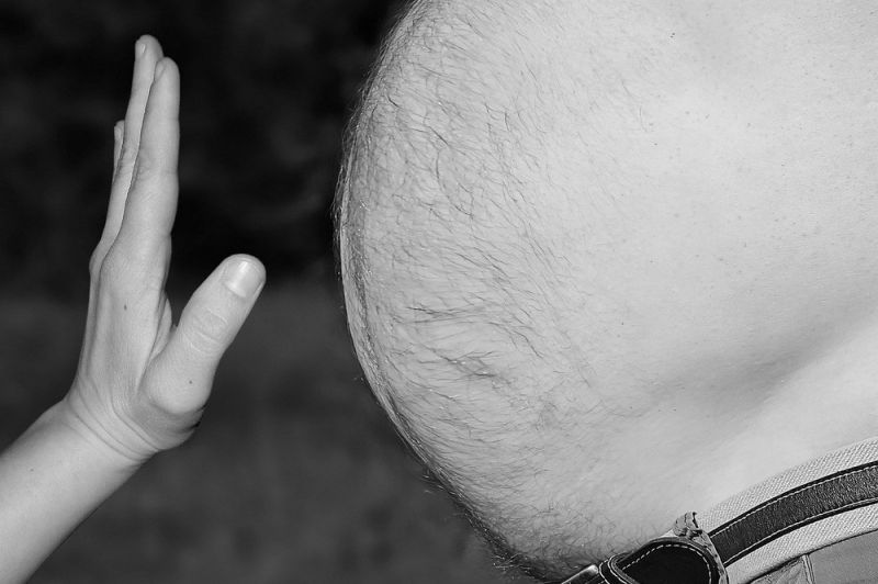 obesity-3247168_1280